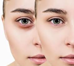 Dermaplane Glow Facial ✨